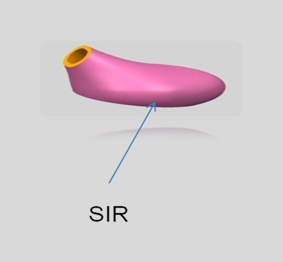 Silicone Earplug Cover 1